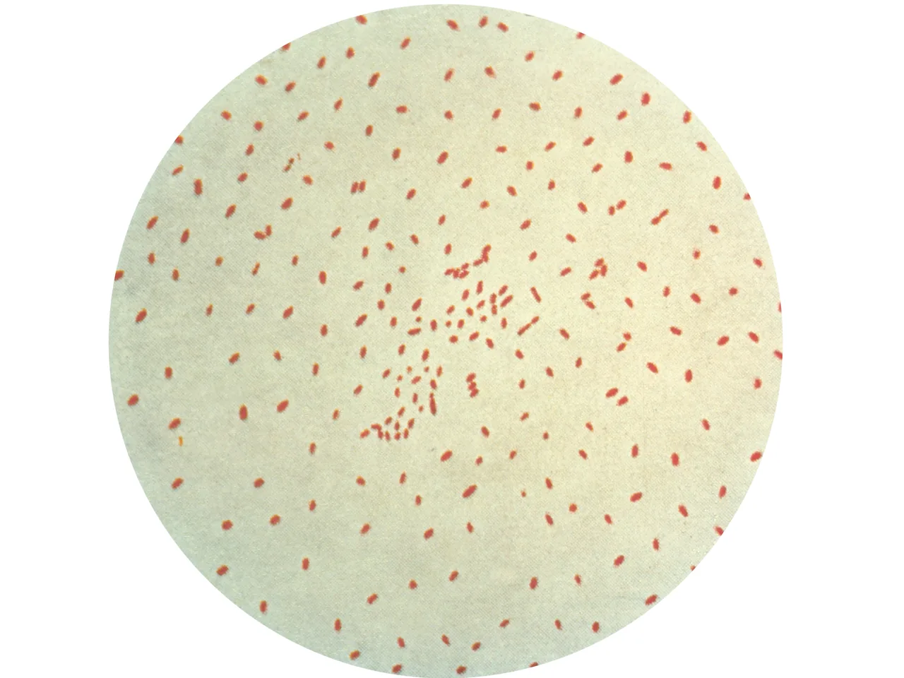 백일해균(Bordetella pertussis) 그람염색 현미경 사진